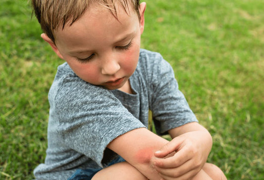 Homemade Bug Spray That Actually Works! - Wellness By Heart